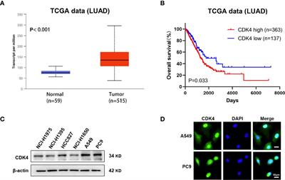 Combining a CDK4/6 Inhibitor With Pemetrexed Inhibits Cell Proliferation and Metastasis in Human Lung Adenocarcinoma